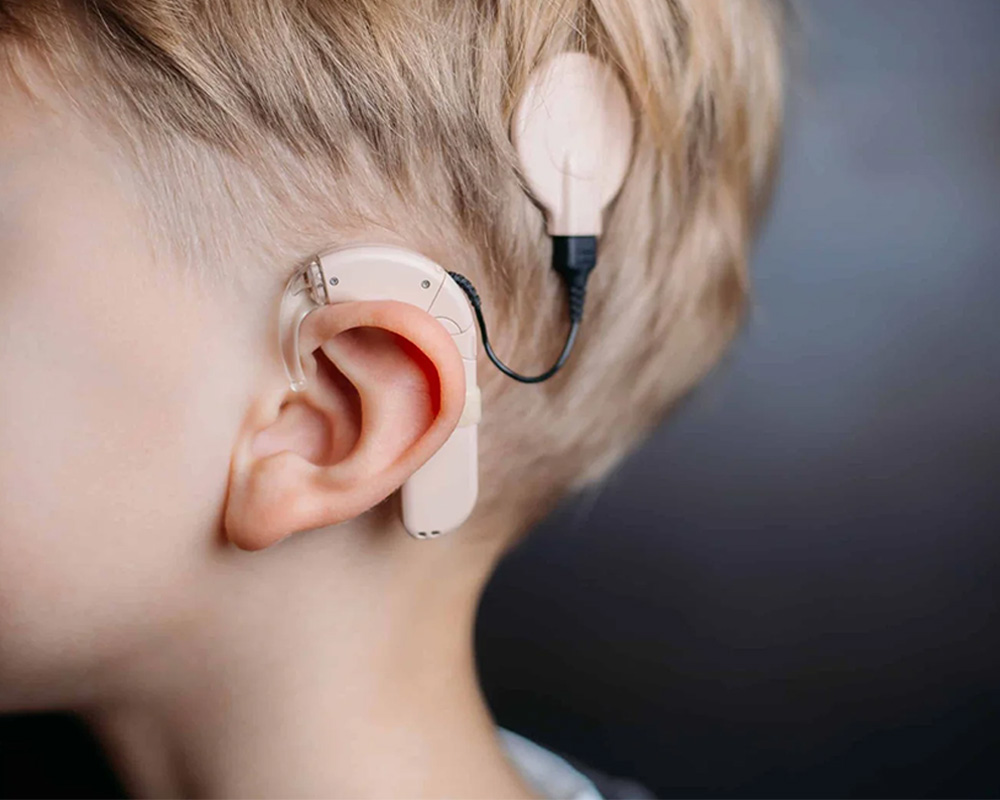 Cochlear Implant Surgery