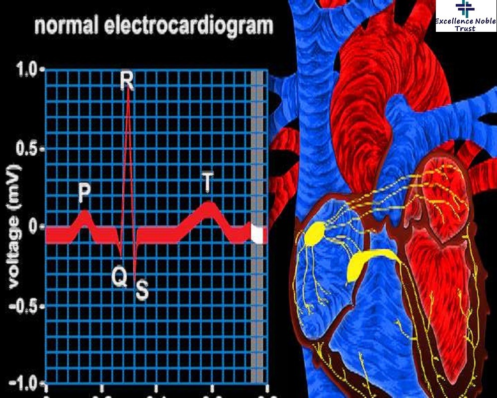 Electrocardiogram Test