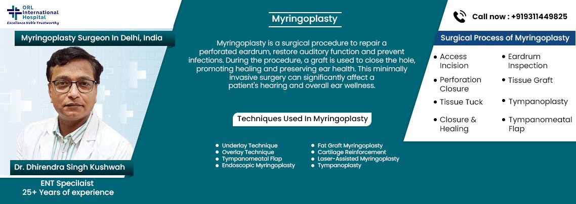 Myringoplasty Treatment in Delhi